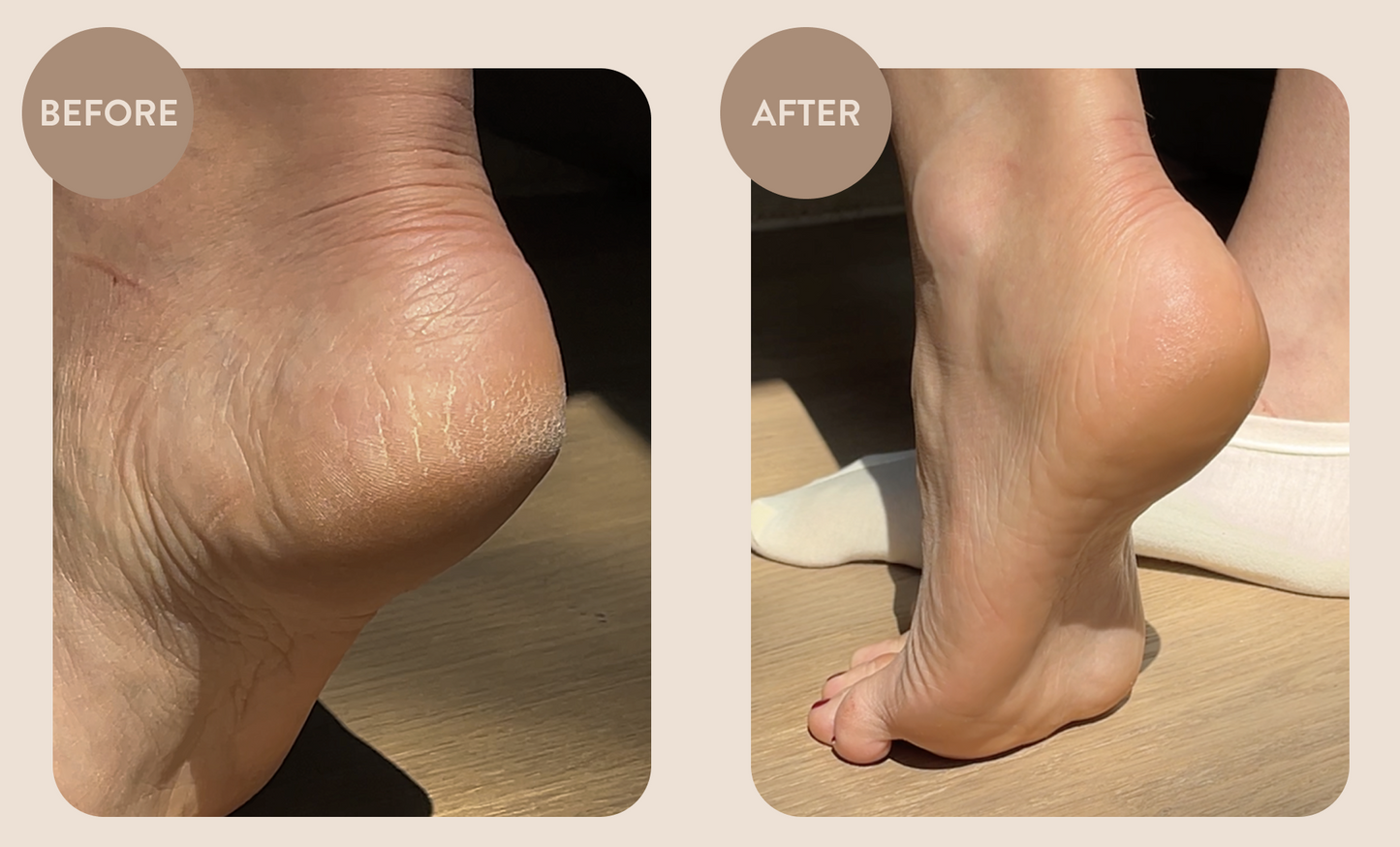 Overnight Foot Rescue Bundle